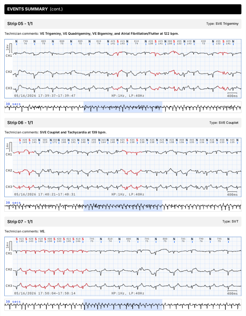 ECG strips report