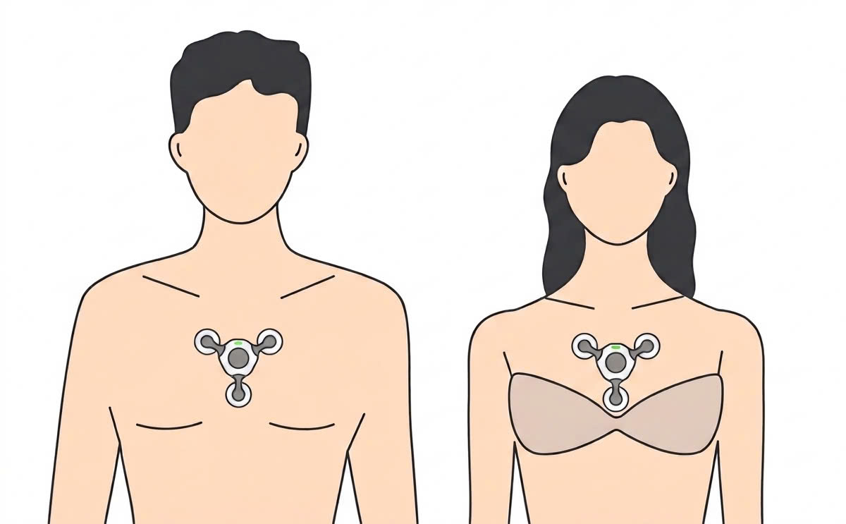 Tư vấn và thiết lập chương trình Holter ECG